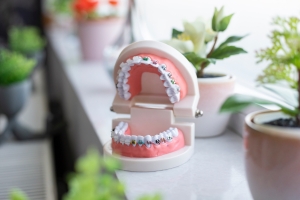 Dentist is Important! Dentist is Important!
